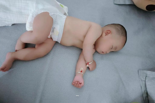 扬中宝宝脸上有白色斑块 扬中宝宝脸上有白色斑块